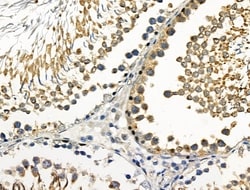 Invitrogen Phospho-Leptin Receptor (Tyr1141) Polyclonal Antibody 100 μL;
