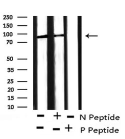 Invitrogen Phospho-Leptin Receptor (Tyr1141) Polyclonal Antibody 100 μL;