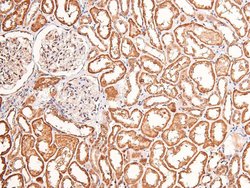 Invitrogen Phospho-FGFR1/FGFR2 (Tyr730, Tyr733) Polyclonal Antibody 100