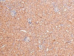 Invitrogen Phospho-FGFR1/FGFR2 (Tyr730, Tyr733) Polyclonal Antibody 100