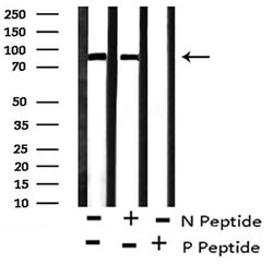 Invitrogen Phospho-FGFR1/FGFR2 (Tyr730, Tyr733) Polyclonal Antibody 100