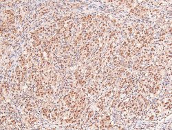 Invitrogen Phospho-IFNAR1 (Ser535) Polyclonal Antibody 100 &mu;L | Buy Online | Invitrogen&trade; | Fisher Scientific