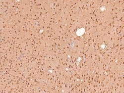 Invitrogen Phospho-IFNAR1 (Ser535) Polyclonal Antibody 100 &mu;L | Buy Online | Invitrogen&trade; | Fisher Scientific