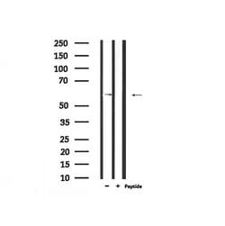 Invitrogen Phospho-IFNAR1 (Ser535) Polyclonal Antibody 100 &mu;L | Buy Online | Invitrogen&trade; | Fisher Scientific