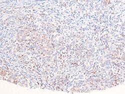 Invitrogen Phospho-ANKRD28 (Ser1007) Polyclonal Antibody 100 &mu;L; Unconjugated:Antibodies,