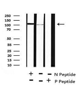 Invitrogen Phospho-ANKRD28 (Ser1007) Polyclonal Antibody 100 &mu;L; Unconjugated:Antibodies,