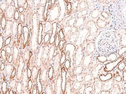 Phospho-Annexin A1 (Tyr21) Polyclonal Antibody:Anticuerpos