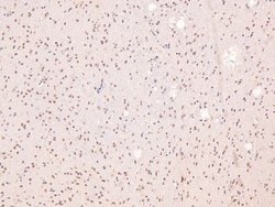 Phospho-Annexin A1 (Tyr21) Polyclonal Antibody:Anticuerpos