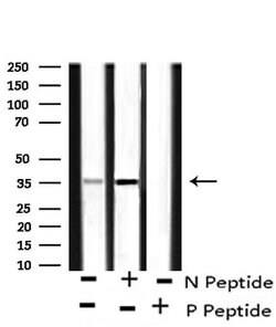 Phospho-Annexin A1 (Tyr21) Polyclonal Antibody:Anticuerpos