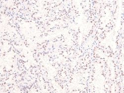 Invitrogen Phospho-Ataxin 3 (Ser256) Polyclonal Antibody 100 &mu;L; Unconjugated:Antibodies,