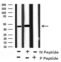 Invitrogen Phospho-Ataxin 3 (Ser256) Polyclonal Antibody 100 &mu;L; Unconjugated:Antibodies,