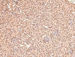 Invitrogen Phospho-BAG3 (Tyr457) Polyclonal Antibody 100 &mu;L; Unconjugated:Antibodies,
