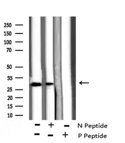 Invitrogen Phospho-BIK (Ser35) Polyclonal Antibody 100 &mu;L; Unconjugated:Antibodies,