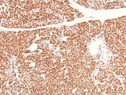 Invitrogen Phospho-Bim (Ser44, Ser104) Polyclonal Antibody 100 μL; Unconjugated:Antibodies,
