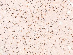 Invitrogen Phospho-Bim (Ser44, Ser104) Polyclonal Antibody 100 μL; Unconjugated:Antibodies,