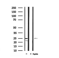 Invitrogen Phospho-Bim (Ser44, Ser104) Polyclonal Antibody 100 μL; Unconjugated:Antibodies,