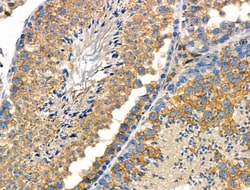 Invitrogen Phospho-Caldesmon (Ser759) Polyclonal Antibody 100 &mu;L | Buy Online | Invitrogen&trade; | Fisher Scientific