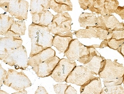 Invitrogen Phospho-Caldesmon (Ser759) Polyclonal Antibody 100 &mu;L | Buy Online | Invitrogen&trade; | Fisher Scientific