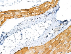 Invitrogen Phospho-Caldesmon (Ser759) Polyclonal Antibody 100 &mu;L | Buy Online | Invitrogen&trade; | Fisher Scientific
