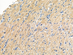 Phospho-Calpain 2 (Ser50) Polyclonal Antibody:Antibodies, Polyclonal