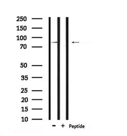 Phospho-Calpain 2 (Ser50) Polyclonal Antibody:Antibodies, Polyclonal