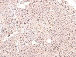 Invitrogen Phospho-ARHGAP31 (Thr789) Polyclonal Antibody 100 &mu;L; Unconjugated:Antibodies,