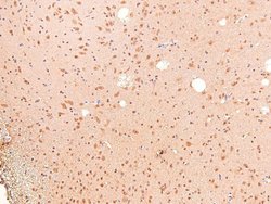 Invitrogen Phospho-ARHGAP31 (Thr789) Polyclonal Antibody 100 &mu;L; Unconjugated:Antibodies,