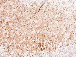 Invitrogen Phospho-ARHGAP31 (Thr789) Polyclonal Antibody 100 &mu;L; Unconjugated:Antibodies,