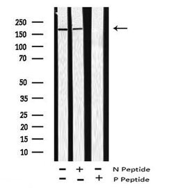 Invitrogen Phospho-ARHGAP31 (Thr789) Polyclonal Antibody 100 &mu;L; Unconjugated:Antibodies,