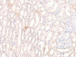 Invitrogen Phospho-Claspin (Ser30) Polyclonal Antibody 100 &mu;L | Buy Online | Invitrogen&trade; | Fisher Scientific