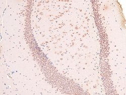 Invitrogen Phospho-Claspin (Ser30) Polyclonal Antibody 100 &mu;L | Buy Online | Invitrogen&trade; | Fisher Scientific