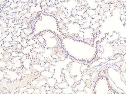 Invitrogen Phospho-Claspin (Ser30) Polyclonal Antibody 100 &mu;L | Buy Online | Invitrogen&trade; | Fisher Scientific