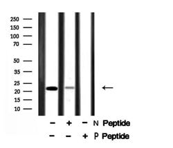 Phospho-Claudin 1 (Tyr210) Polyclonal Antibody 100 &mu;L | Buy Online | Invitrogen | Fisher Scientific