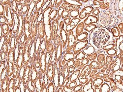 Invitrogen Phospho-CtBP1/CtBP2 (Ser158, Ser164) Polyclonal Antibody 100