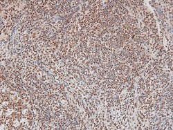 Invitrogen Phospho-CtBP1/CtBP2 (Ser158, Ser164) Polyclonal Antibody 100