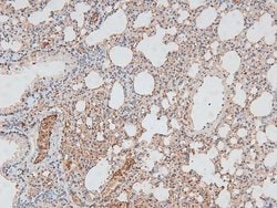 Invitrogen Phospho-CtBP1/CtBP2 (Ser158, Ser164) Polyclonal Antibody 100
