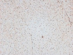Invitrogen Phospho-CtBP1/CtBP2 (Ser158, Ser164) Polyclonal Antibody 100
