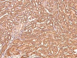 Invitrogen Phospho-CtBP1/CtBP2 (Ser158, Ser164) Polyclonal Antibody 100