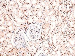 Invitrogen Phospho-CUX1 (Ser1237) Polyclonal Antibody 100 &mu;L; Unconjugated:Antibodies,