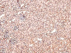 Invitrogen Phospho-CUX1 (Ser1237) Polyclonal Antibody 100 &mu;L; Unconjugated:Antibodies,
