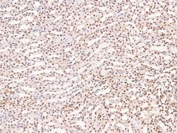 Invitrogen Phospho-CUX1 (Ser1237) Polyclonal Antibody 100 &mu;L; Unconjugated:Antibodies,