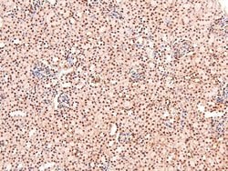 Invitrogen Phospho-CUX1 (Ser1237) Polyclonal Antibody 100 &mu;L; Unconjugated:Antibodies,