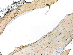 Phospho-RCAN1 (Ser163) Polyclonal Antibody:Antibodies, Polyclonal
