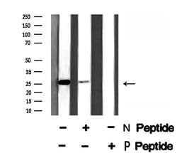Invitrogen Phospho-NTAL (Tyr136) Polyclonal Antibody 100 &mu;L; Unconjugated:Antibodies,