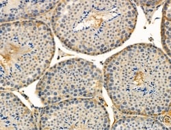 Invitrogen Phospho-MKP3 (Ser197) Polyclonal Antibody 100 &mu;L | Buy Online | Invitrogen&trade; | Fisher Scientific