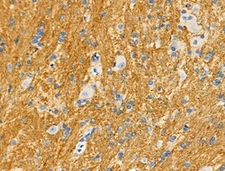 Invitrogen Phospho-MKP3 (Ser197) Polyclonal Antibody 100 &mu;L | Buy Online | Invitrogen&trade; | Fisher Scientific