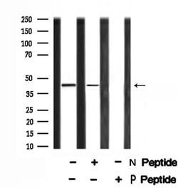 Invitrogen Phospho-MKP3 (Ser197) Polyclonal Antibody 100 &mu;L | Buy Online | Invitrogen&trade; | Fisher Scientific