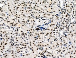Invitrogen Phospho-DUSP16 (Ser446) Polyclonal Antibody 100 &mu;L; Unconjugated:Antibodies,