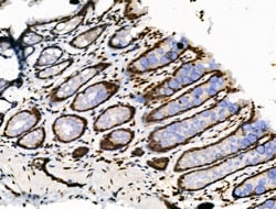 Invitrogen Phospho-DUSP16 (Ser446) Polyclonal Antibody 100 &mu;L; Unconjugated:Antibodies,