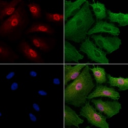 Invitrogen Phospho-NFATC1 (Ser172) Polyclonal Antibody 100 μL; Unconjugated:Antibodies,